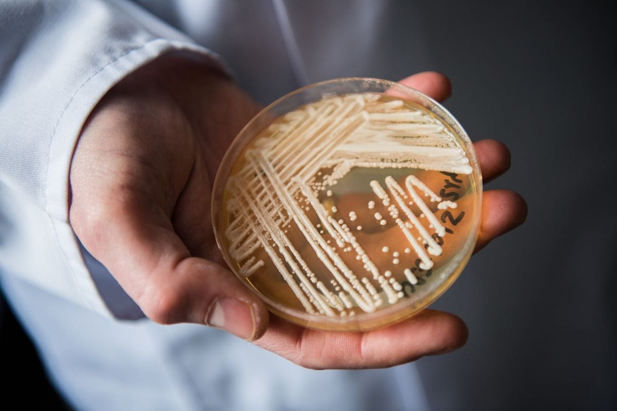 Cases of potentially deadly fungus detected in 27 states. What to know