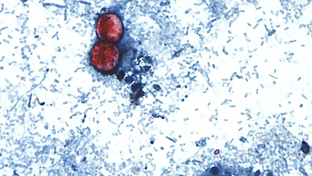 NH DHHS: Two cases of cyclosporiasis confirmed in the state in 2026